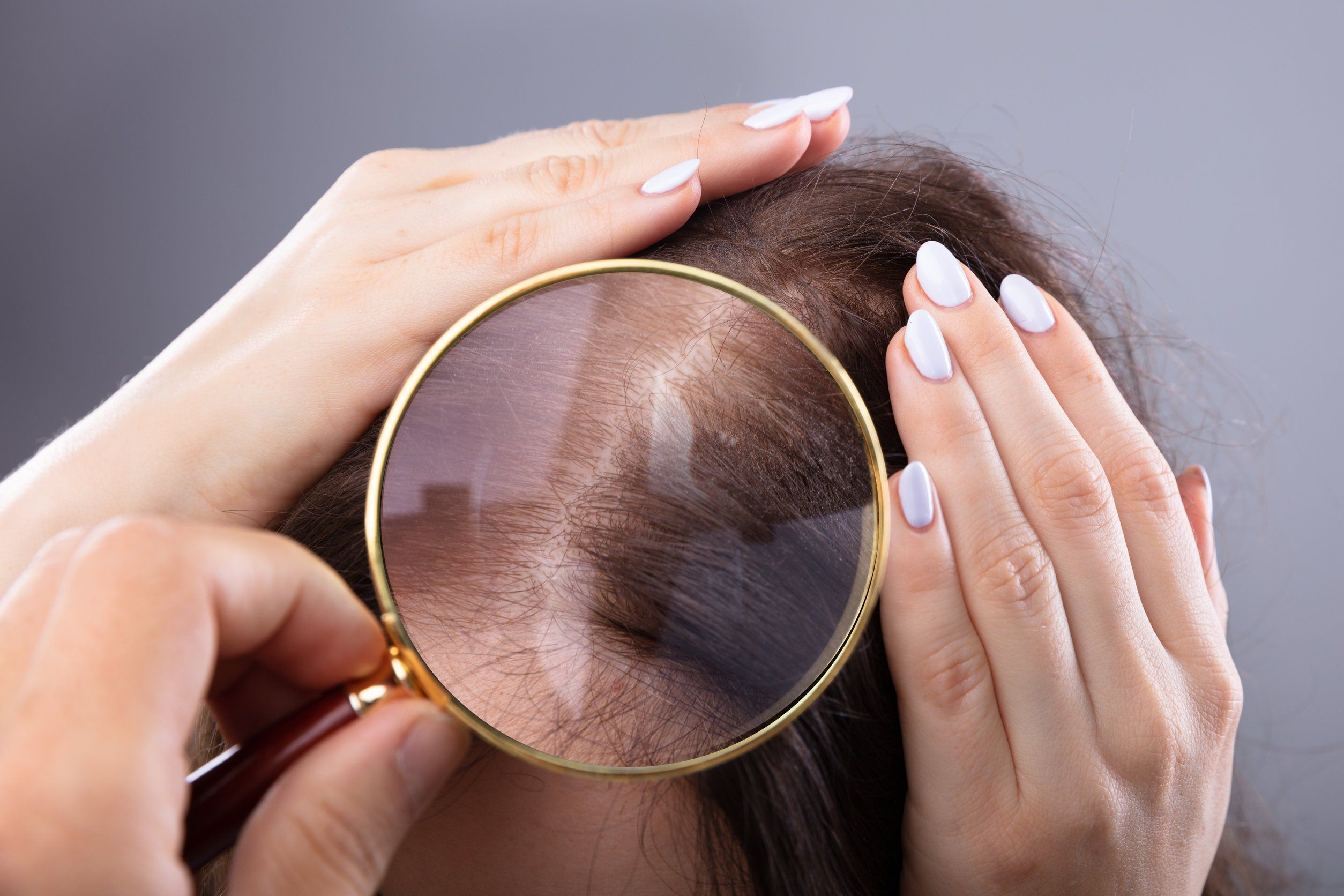 Treating Alopecia: 7 Types of Hair Loss